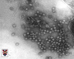 Увеличават се тежките случаи на новия грип