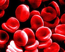 Кръвната група влияе върху риска от инсулт