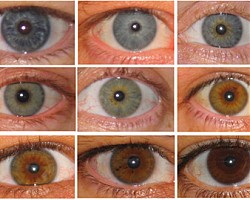 Цветът на очите е свързан с кожните заболявания