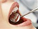 Проблемите със зъбите: верига от последици при лоша хигиена
