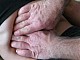 Специален масаж помага при заболявания на белите дробове