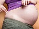 Бременност и диабет