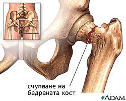 последици