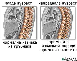 рискови фактори