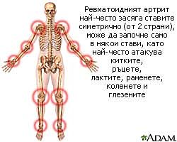 симптоми