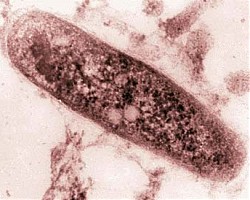 Опасна форма на туберкулоза откриха в САЩ