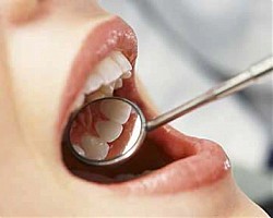 Проблемите със зъбите: верига от последици при лоша хигиена