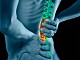 5 чести въпроса за болките в гърба