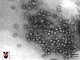 Започва разработване на ваксина срещу свинския грип под контрола на СЗО